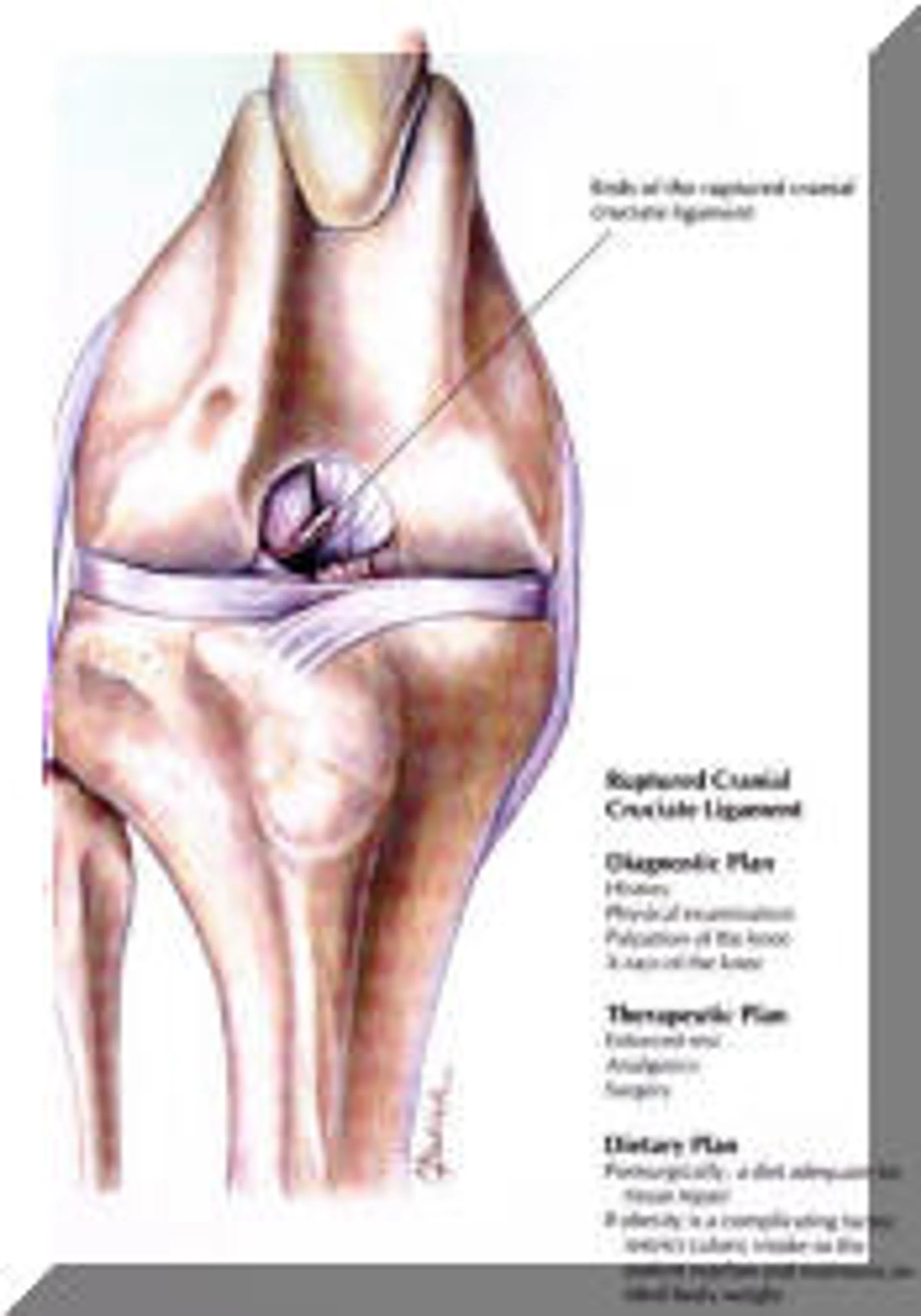 TTA Knee Surgery